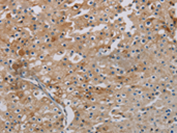 Rabbit Polyclonal Antibody to PHKA2