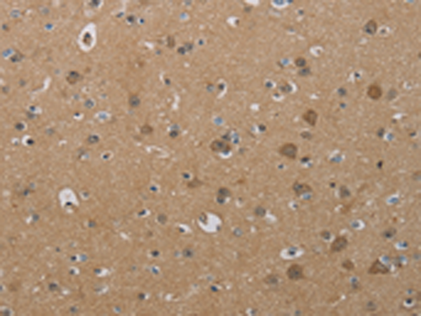 Rabbit Polyclonal Antibody to PHKG2