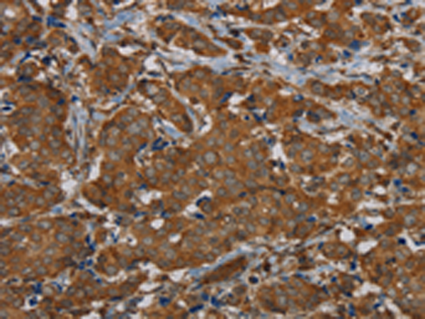 Rabbit Polyclonal Antibody to PIK3CD