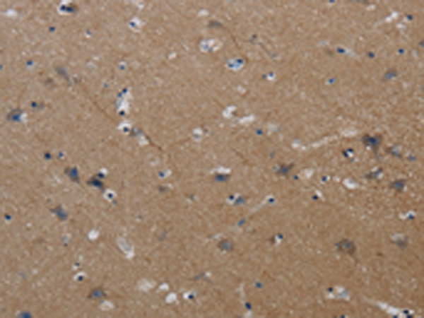 Rabbit Polyclonal Antibody to PIK3CG