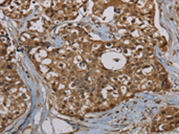 Rabbit Polyclonal Antibody to PNN