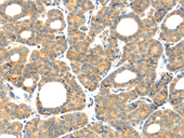 Rabbit Polyclonal Antibody to PLAGL2