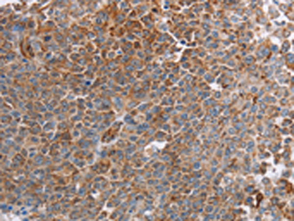 Rabbit Polyclonal Antibody to PLXNA2