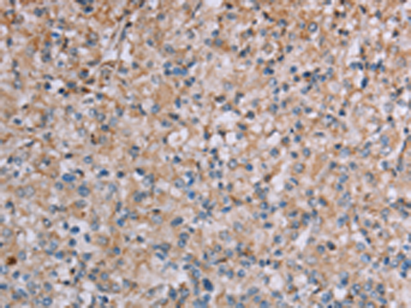 Rabbit Polyclonal Antibody to PLXNA4