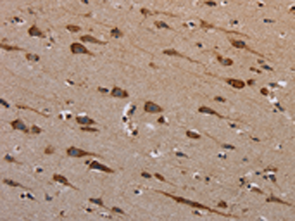 Rabbit Polyclonal Antibody to PLXNB1