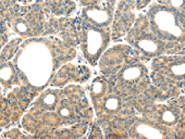 Rabbit Polyclonal Antibody to PLXNB2