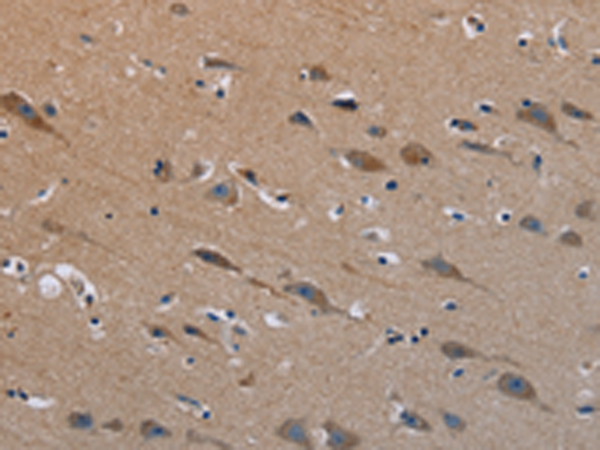 Rabbit Polyclonal Antibody to PLXND1