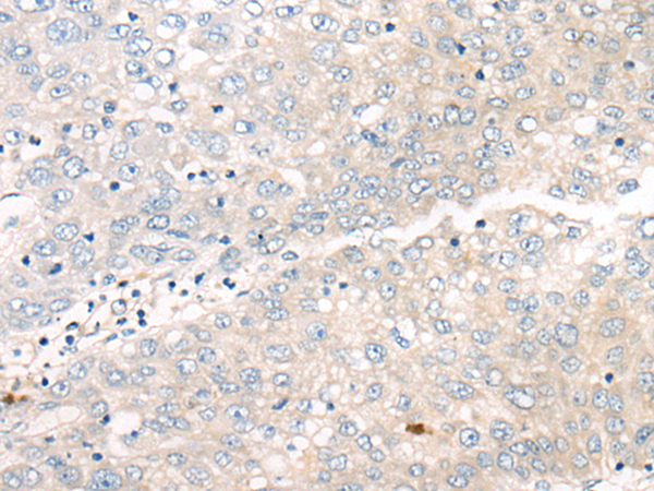 Rabbit Polyclonal Antibody to PNPO