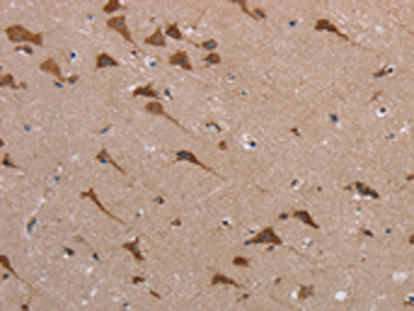 Rabbit Polyclonal Antibody to POMT1