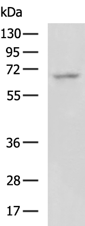 Rabbit Polyclonal Antibody to POU6F2