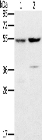 Rabbit Polyclonal Antibody to PPM1F
