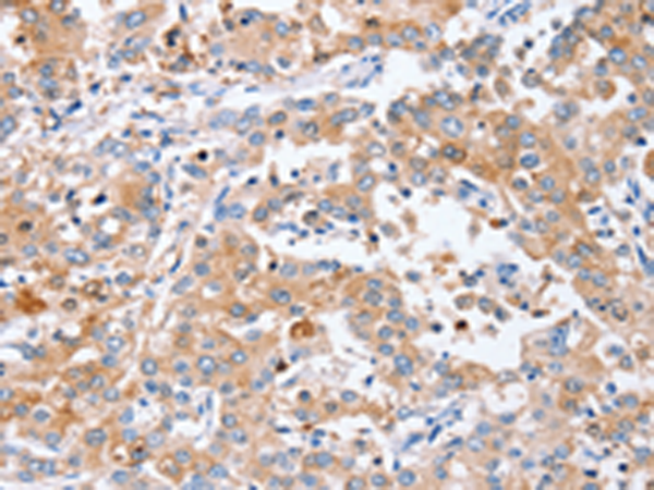 Rabbit Polyclonal Antibody to PPOX