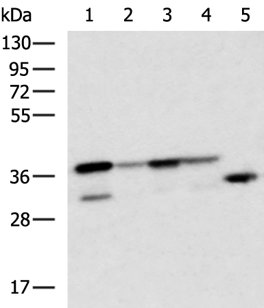 Rabbit Polyclonal Antibody to CENPV