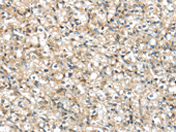 Rabbit Polyclonal Antibody to PRSS8