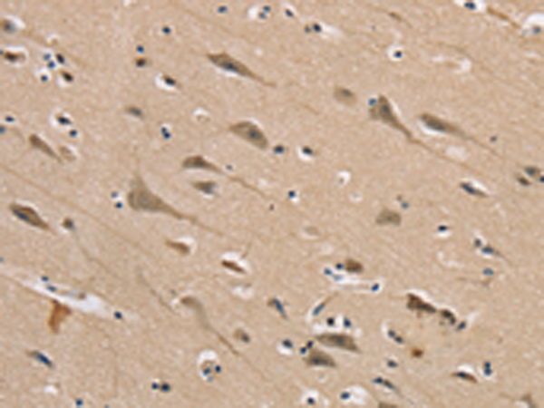 Rabbit Polyclonal Antibody to DLG2