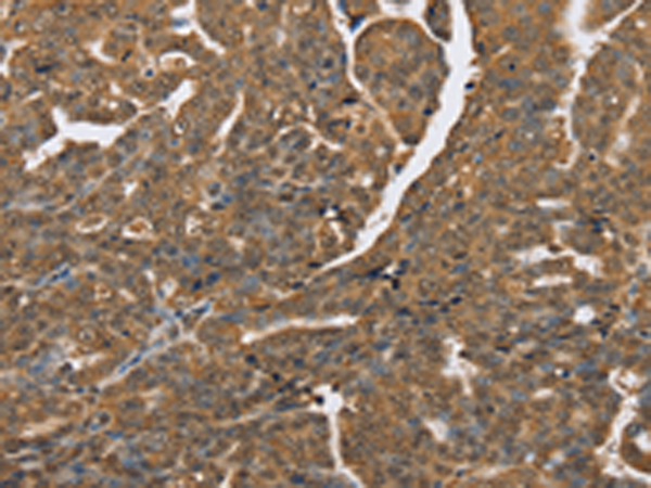 Rabbit Polyclonal Antibody to PTPN20