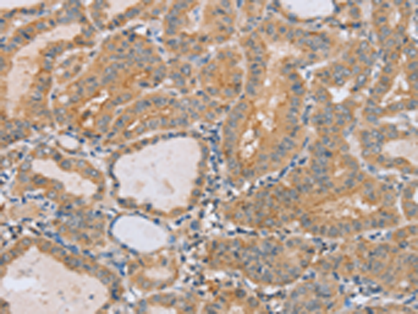 Rabbit Polyclonal Antibody to PTPN4