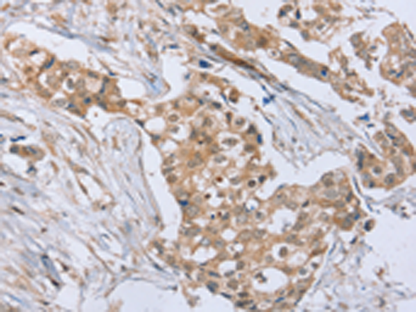 Rabbit Polyclonal Antibody to RAB8B