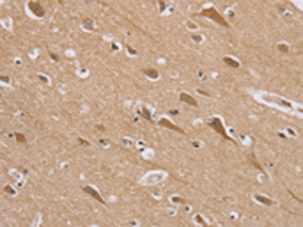 Rabbit Polyclonal Antibody to RAB6C