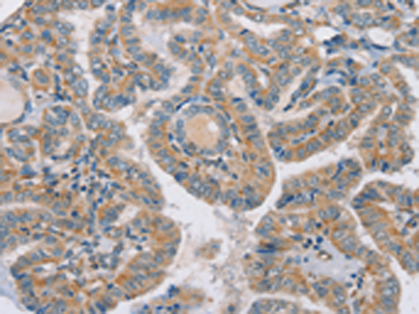 Rabbit Polyclonal Antibody to RAB21