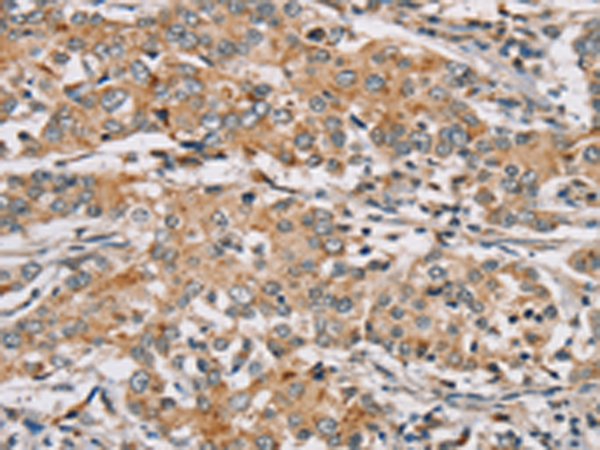 Rabbit Polyclonal Antibody to RAB24