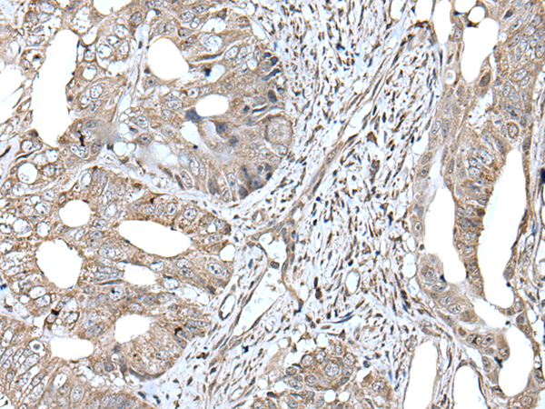 Rabbit Polyclonal Antibody to RAD54B