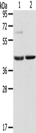 Rabbit Polyclonal Antibody to HIF1AN