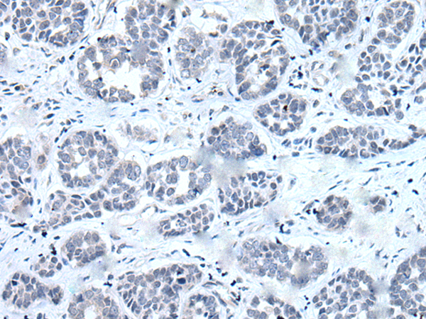 Rabbit Polyclonal Antibody to RARG