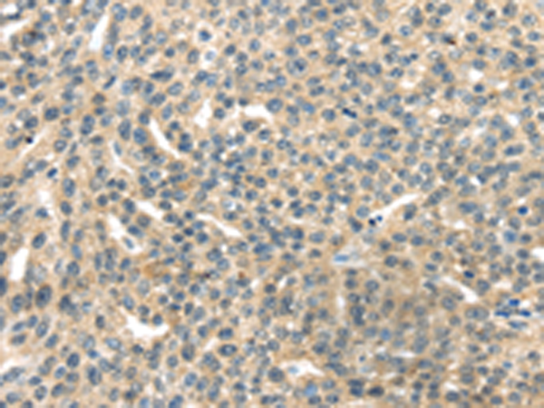 Rabbit Polyclonal Antibody to RASA2