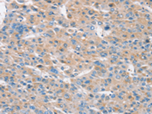 Rabbit Polyclonal Antibody to RASA3