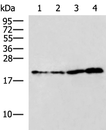 Rabbit Polyclonal Antibody to RBM38