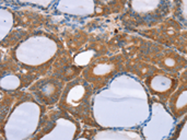 Rabbit Polyclonal Antibody to NOS2