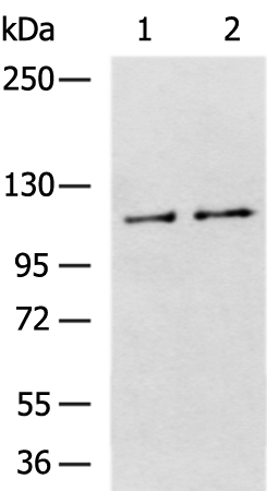 Rabbit Polyclonal Antibody to ZMIZ1