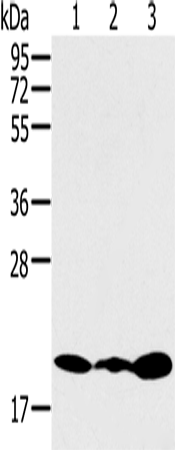 Rabbit Polyclonal Antibody to RNF5