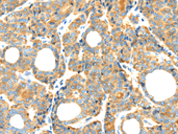 Rabbit Polyclonal Antibody to RIPK4