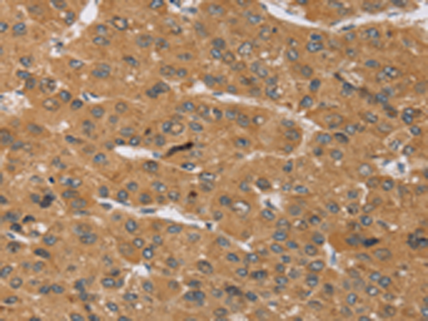 Rabbit Polyclonal Antibody to KCNJ15