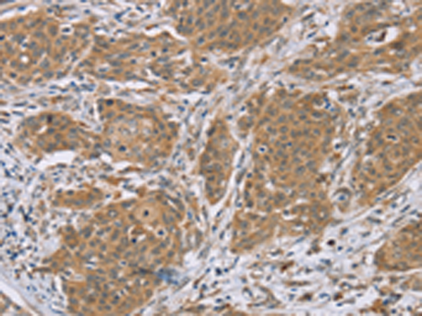 Rabbit Polyclonal Antibody to RNF139
