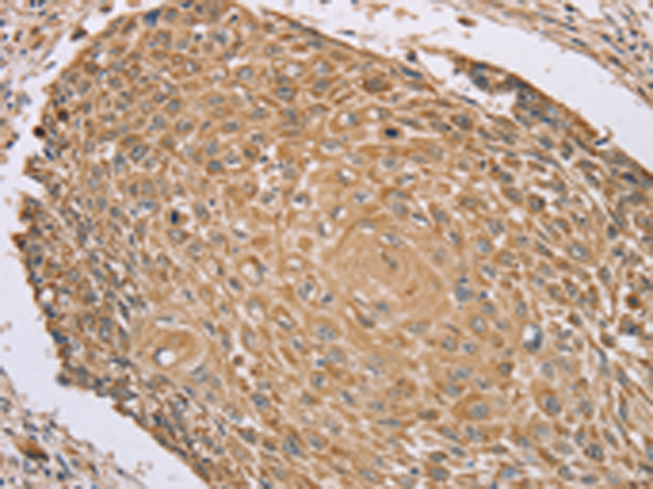 Rabbit Polyclonal Antibody to RNF148