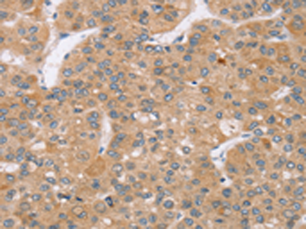 Rabbit Polyclonal Antibody to TRIM34