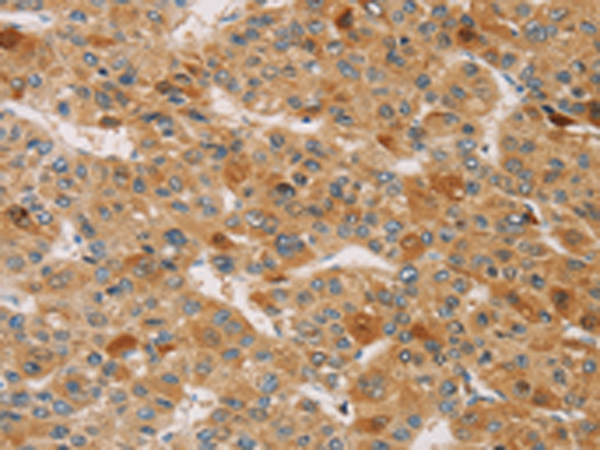 Rabbit Polyclonal Antibody to TRIM40