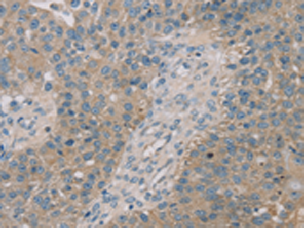 Rabbit Polyclonal Antibody to ROBO2