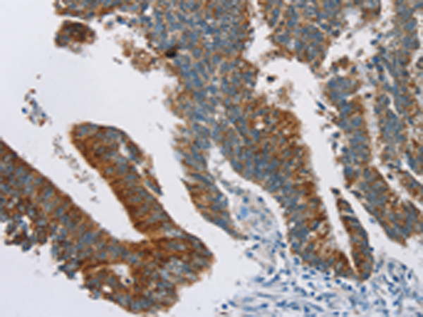 Rabbit Polyclonal Antibody to RPS6KA2