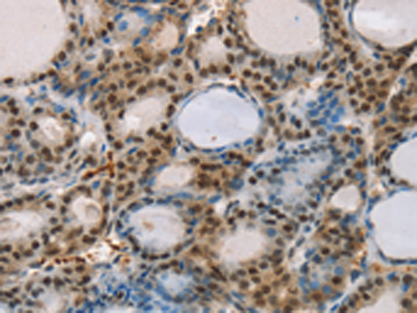 Rabbit Polyclonal Antibody to RUNX1T1