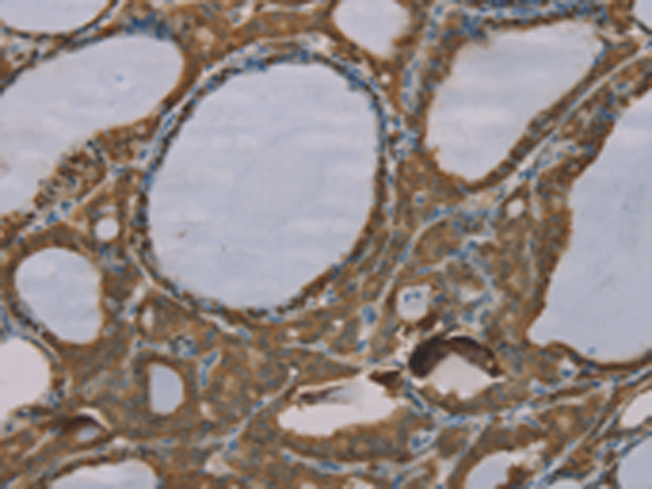Rabbit Polyclonal Antibody to S100A6