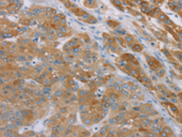 Rabbit Polyclonal Antibody to SAMD4A