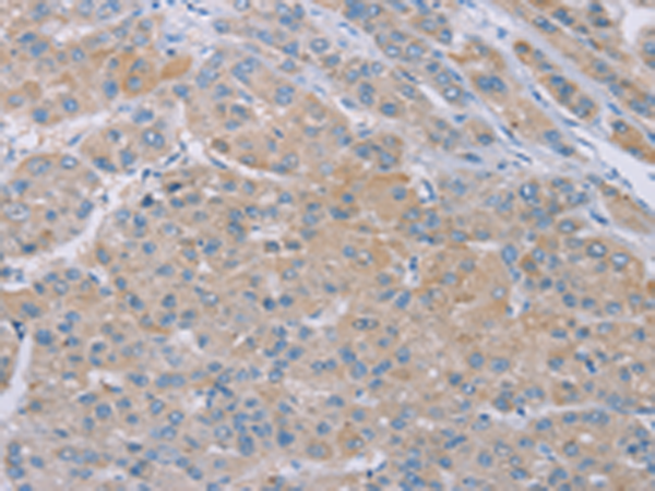 Rabbit Polyclonal Antibody to SAMD4B