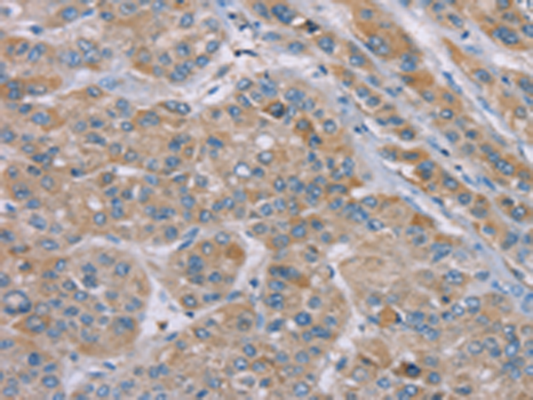 Rabbit Polyclonal Antibody to SAMD9