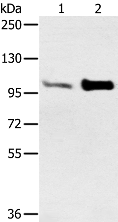 Rabbit Polyclonal Antibody to ACTN2