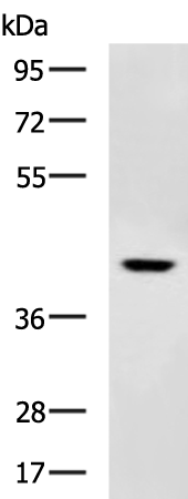Rabbit Polyclonal Antibody to SCD