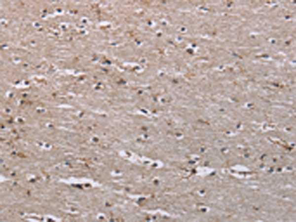 Rabbit Polyclonal Antibody to IQCJ